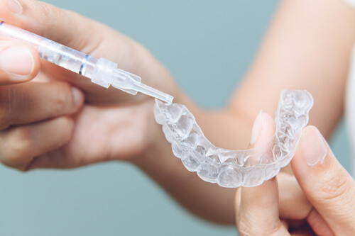 Tooth Whitening - Cannock Road Dental
